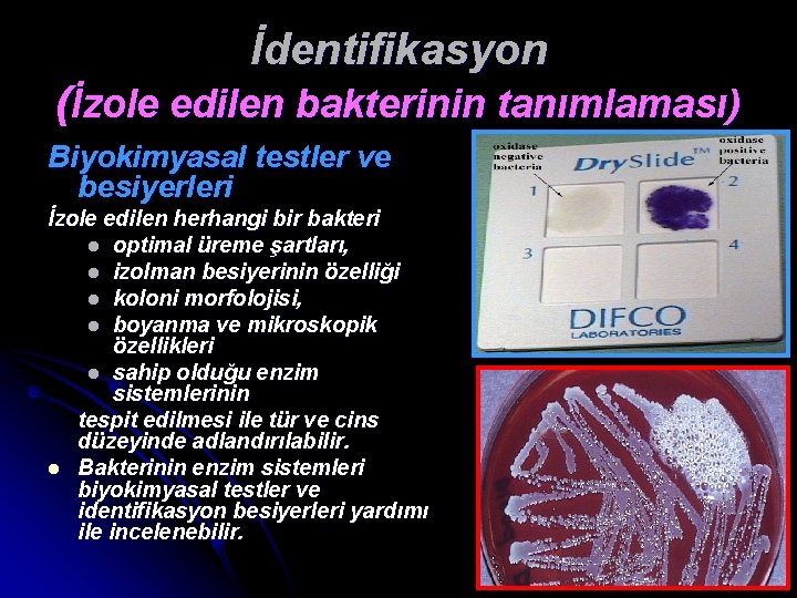 İdentifikasyon (İzole edilen bakterinin tanımlaması) Biyokimyasal testler ve besiyerleri İzole edilen herhangi bir bakteri