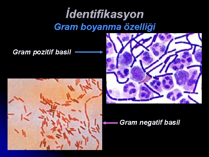 İdentifikasyon Gram boyanma özelliği Gram pozitif basil Gram negatif basil 