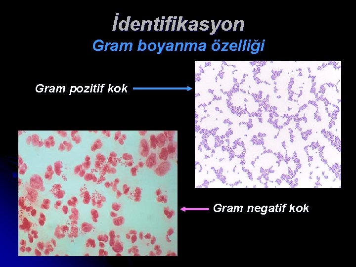 İdentifikasyon Gram boyanma özelliği Gram pozitif kok Gram negatif kok 