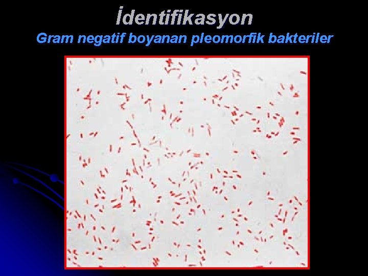 İdentifikasyon Gram negatif boyanan pleomorfik bakteriler 