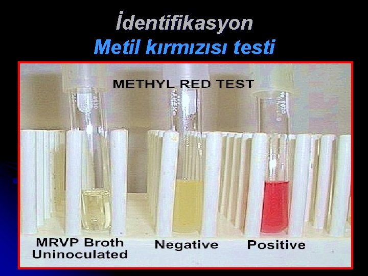 İdentifikasyon Metil kırmızısı testi 