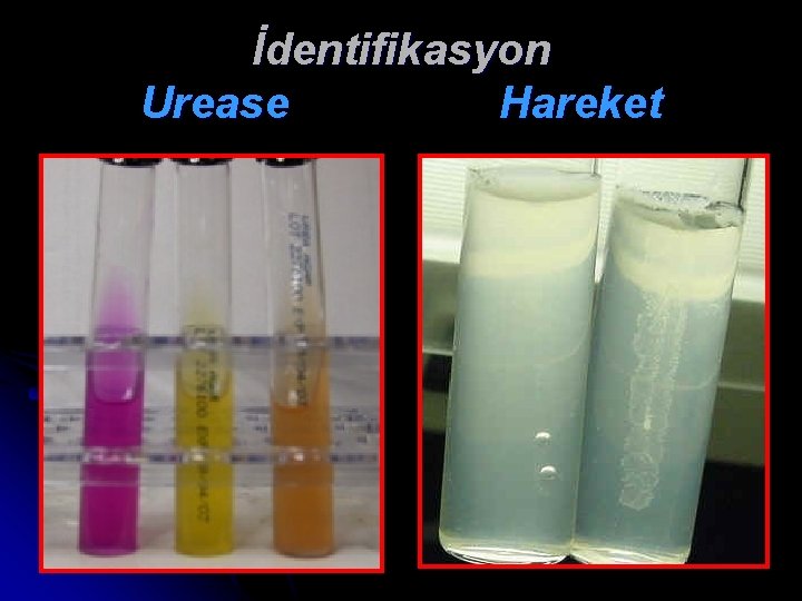 İdentifikasyon Urease Hareket 