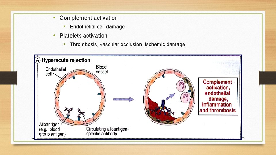  • Complement activation • Endothelial cell damage • Platelets activation • Thrombosis, vascular