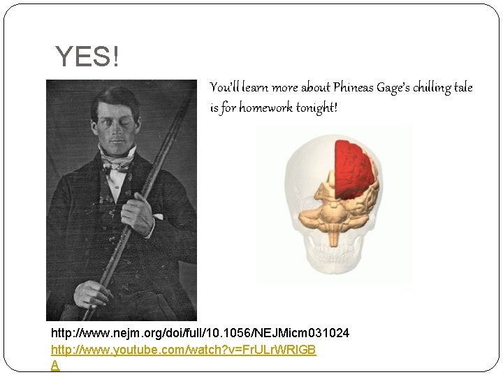 YES! You’ll learn more about Phineas Gage’s chilling tale is for homework tonight! http: