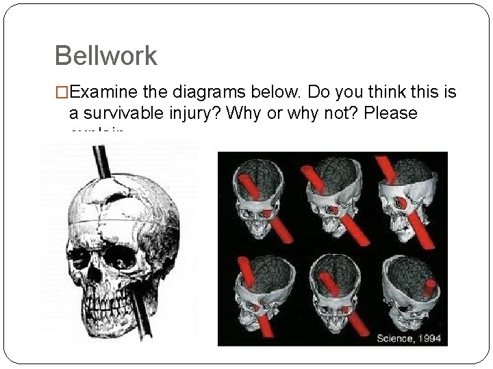 Bellwork �Examine the diagrams below. Do you think this is a survivable injury? Why