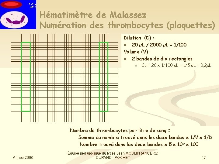 Hématimètre de Malassez Numération des thrombocytes (plaquettes) Dilution (D) : n 20 µL /