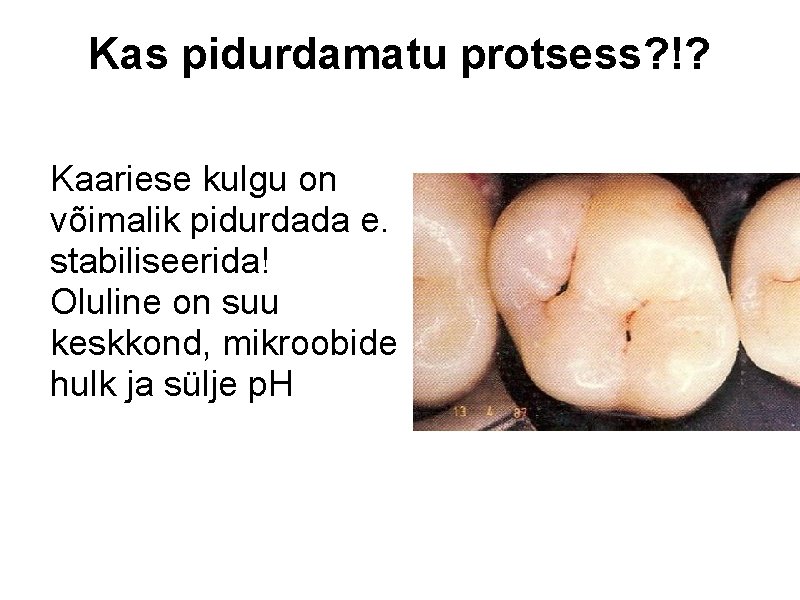 Kas pidurdamatu protsess? !? Kaariese kulgu on võimalik pidurdada e. stabiliseerida! Oluline on suu