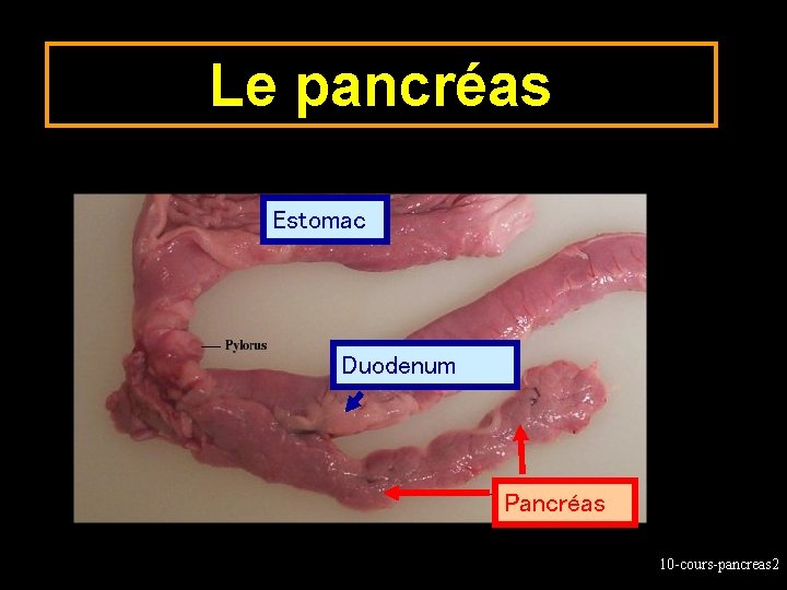 Le pancréas Estomac Duodenum Pancréas 10 -cours-pancreas 2 