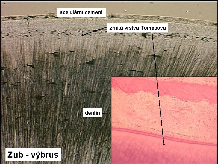 acelulární cement zrnitá vrstva Tomesova Zub - výbrus dentin 