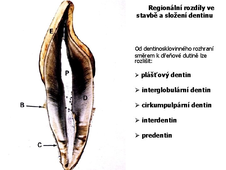 Regionální rozdíly ve stavbě a složení dentinu Od dentinosklovinného rozhraní směrem k dřeňové dutině