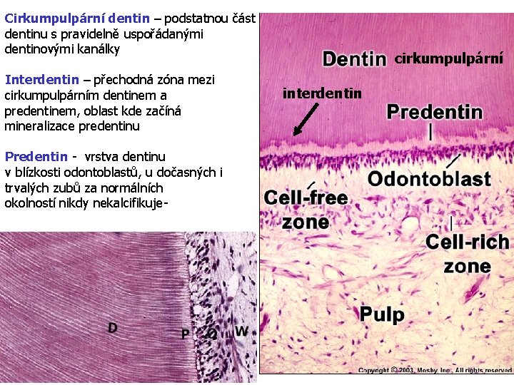 Cirkumpulpární dentin – podstatnou část dentinu s pravidelně uspořádanými dentinovými kanálky Interdentin – přechodná