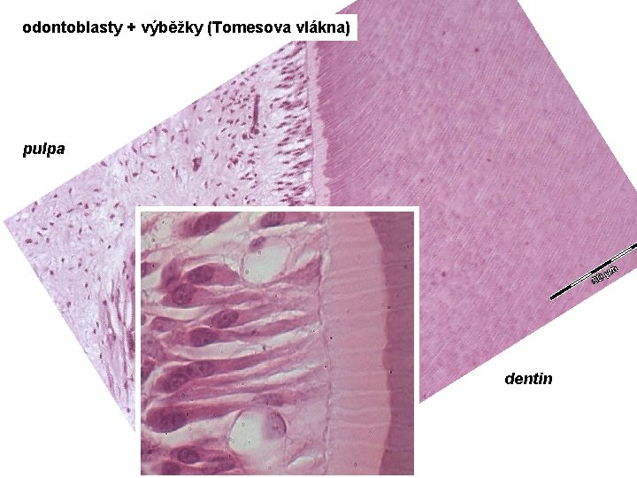 odontoblasty + výběžky (Tomesova vlákna) pulpa dentin 