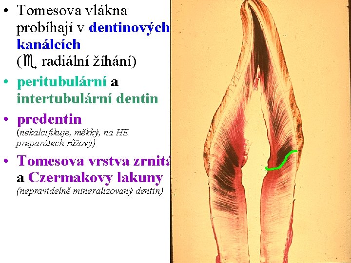  • Tomesova vlákna probíhají v dentinových kanálcích ( radiální žíhání) • peritubulární a