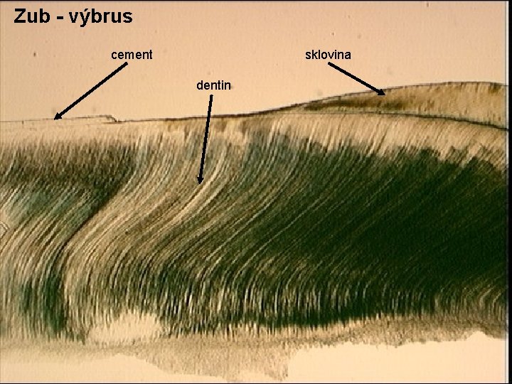 Zub - výbrus cement sklovina dentin 