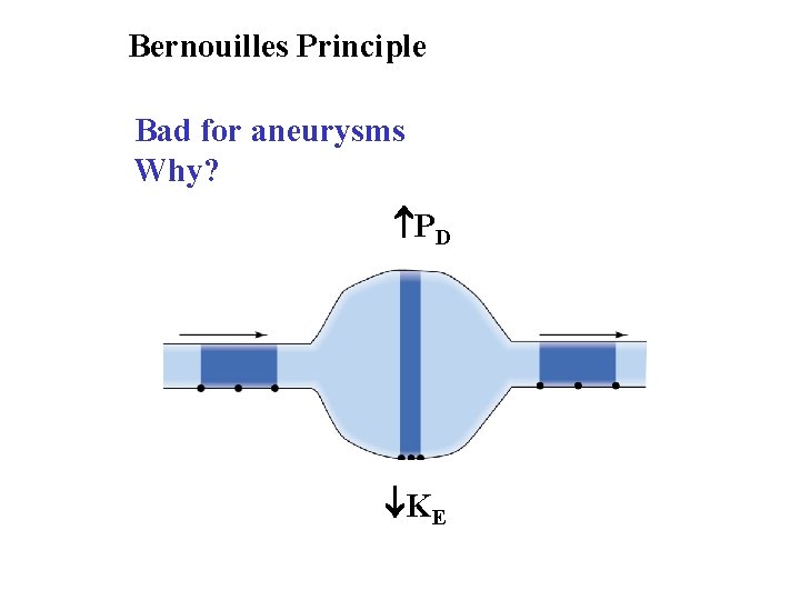 Bernouilles Principle Bad for aneurysms Why? PD KE 