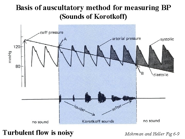 Basis of auscultatory method for measuring BP (Sounds of Korotkoff) Turbulent flow is noisy