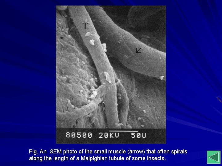 Fig. An SEM photo of the small muscle (arrow) that often spirals along the