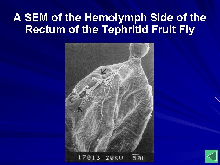 A SEM of the Hemolymph Side of the Rectum of the Tephritid Fruit Fly