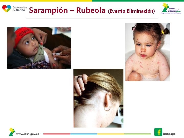 Sarampión – Rubeola (Evento Eliminación) 