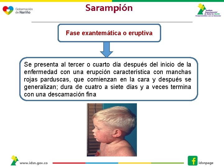 Sarampión Fase exantemática o eruptiva Se presenta al tercer o cuarto día después del