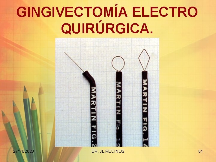 GINGIVECTOMÍA ELECTRO QUIRÚRGICA. 27/11/2020 DR. JL RECINOS 61 