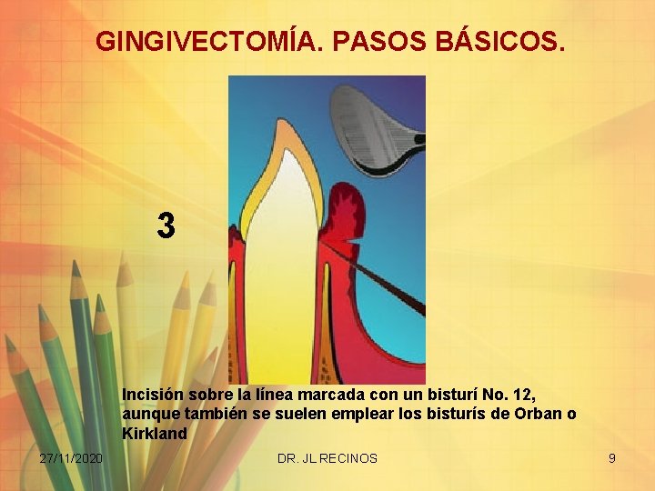 GINGIVECTOMÍA. PASOS BÁSICOS. 3 Incisión sobre la línea marcada con un bisturí No. 12,