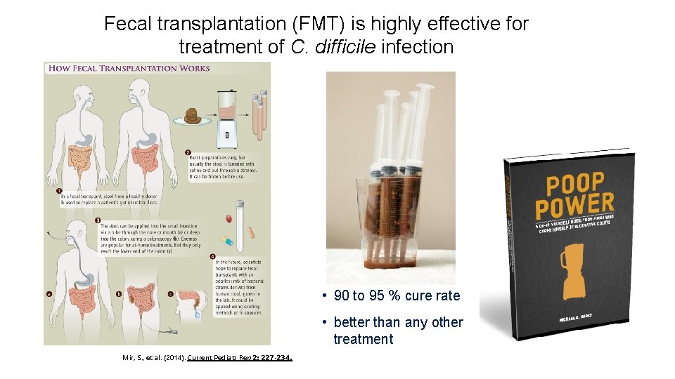 Fecal transplantation (FMT) is highly effective for treatment of C. difficile infection • 90