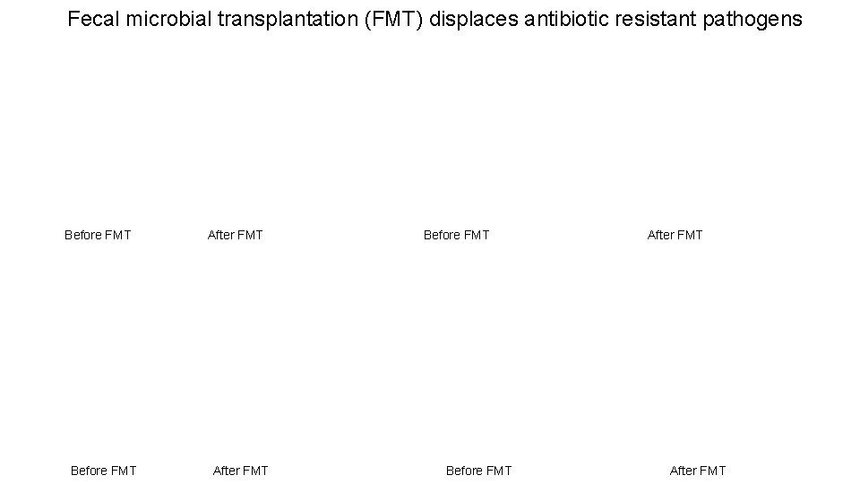 Fecal microbial transplantation (FMT) displaces antibiotic resistant pathogens Before FMT After FMT 