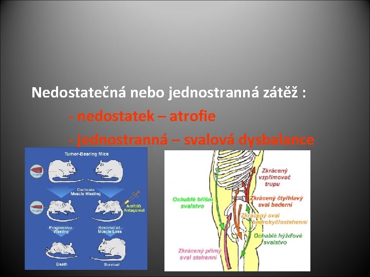 Nedostatečná nebo jednostranná zátěž : - nedostatek – atrofie - jednostranná – svalová dysbalance