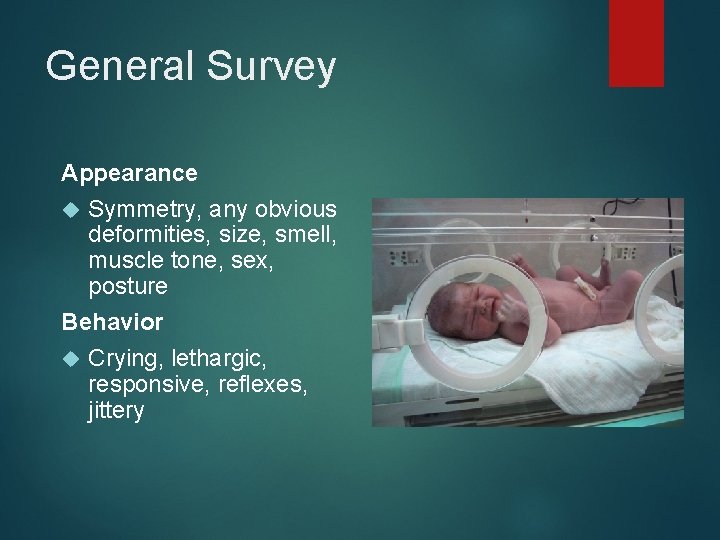 General Survey Appearance Symmetry, any obvious deformities, size, smell, muscle tone, sex, posture Behavior