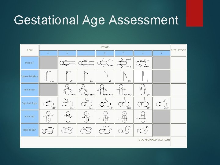 Gestational Age Assessment 