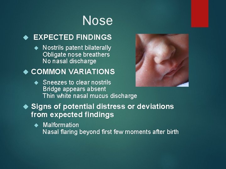 Nose EXPECTED FINDINGS COMMON VARIATIONS Nostrils patent bilaterally Obligate nose breathers No nasal discharge