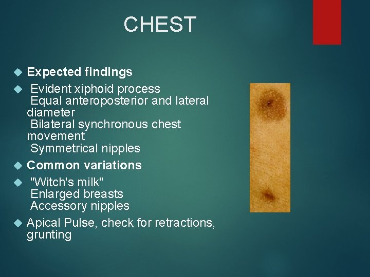 CHEST Expected findings Evident xiphoid process Equal anteroposterior and lateral diameter Bilateral synchronous chest