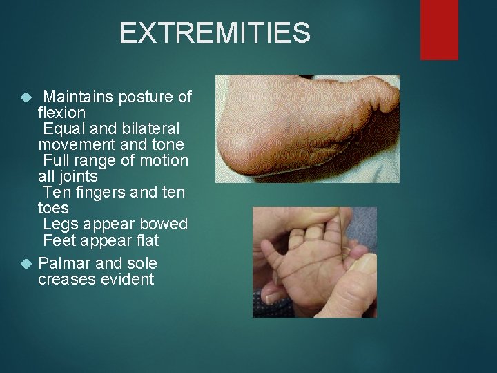 EXTREMITIES Maintains posture of flexion Equal and bilateral movement and tone Full range of