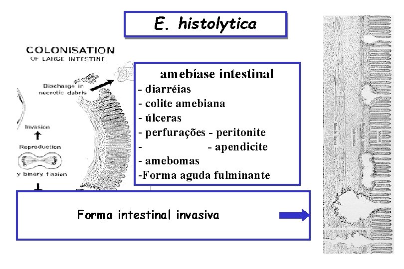 E. histolytica amebíase intestinal - diarréias - colite amebiana - úlceras Forma intestinal -