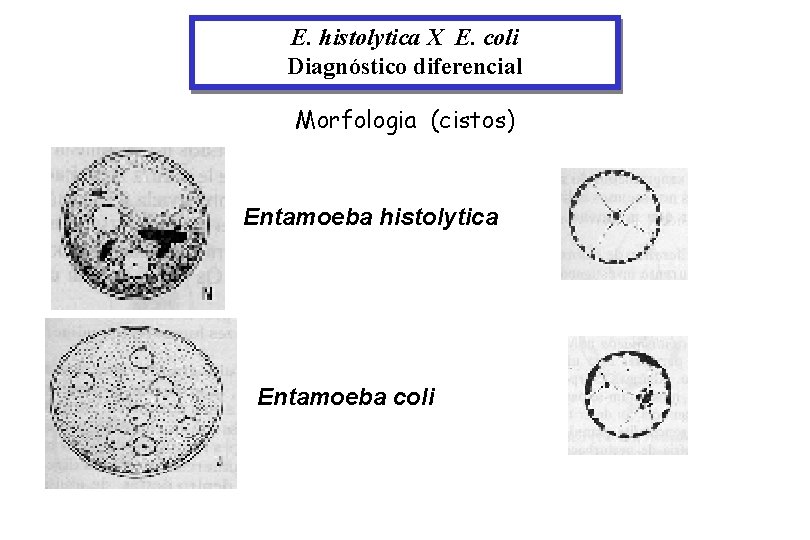 E. histolytica X E. coli Diagnóstico diferencial Morfologia (cistos) Entamoeba histolytica Entamoeba coli 