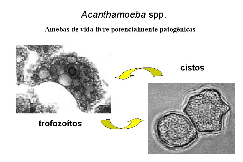Acanthamoeba spp. Amebas de vida livre potencialmente patogênicas cistos trofozoítos 
