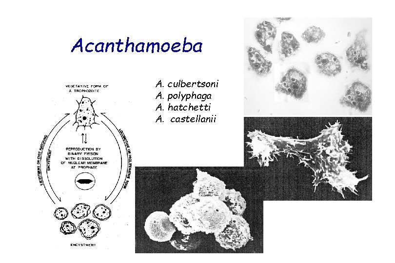 Acanthamoeba A. culbertsoni A. polyphaga A. hatchetti A. castellanii 
