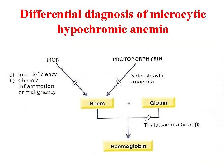 Differential diagnosis of microcytic hypochromic anemia 2 nd year Medicine- May 2008 13 