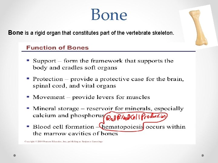 Bone is a rigid organ that constitutes part of the vertebrate skeleton. 