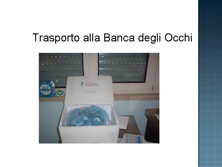 Trasporto alla Banca degli Occhi 