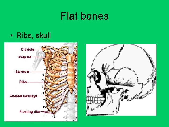 Flat bones • Ribs, skull 