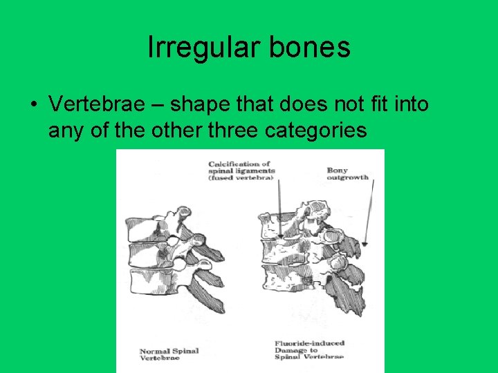 Irregular bones • Vertebrae – shape that does not fit into any of the
