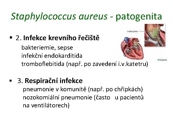 Staphylococcus aureus - patogenita § 2. Infekce krevního řečiště bakteriemie, sepse infekční endokarditida tromboflebitida