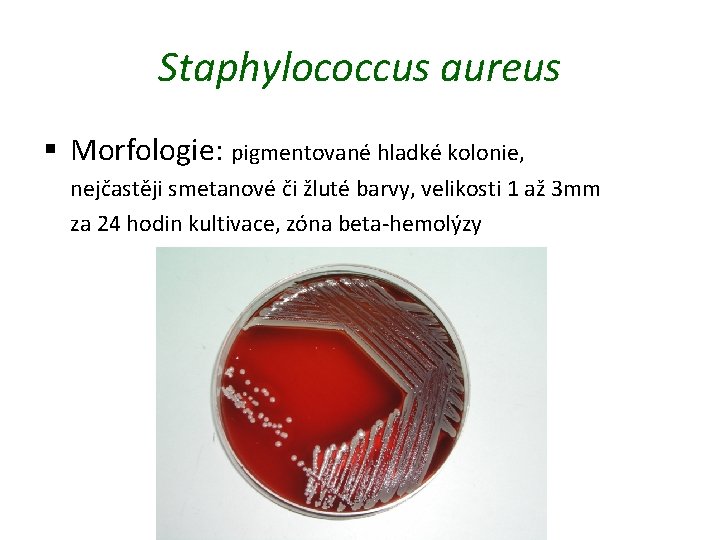 Staphylococcus aureus § Morfologie: pigmentované hladké kolonie, nejčastěji smetanové či žluté barvy, velikosti 1