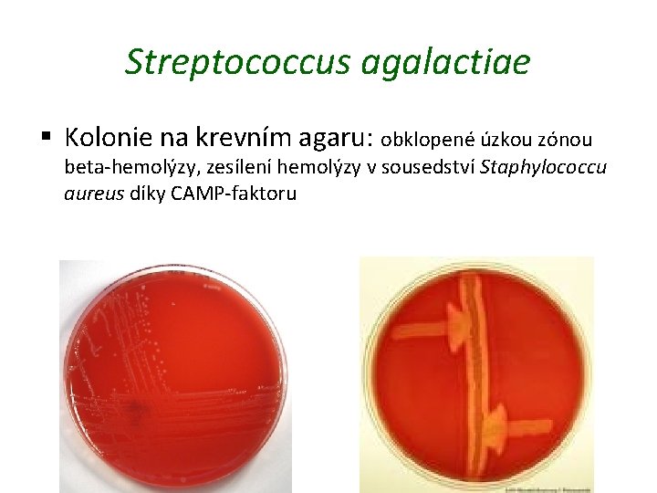 Streptococcus agalactiae § Kolonie na krevním agaru: obklopené úzkou zónou beta-hemolýzy, zesílení hemolýzy v