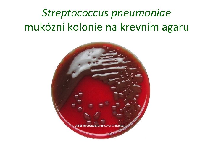 Streptococcus pneumoniae mukózní kolonie na krevním agaru 
