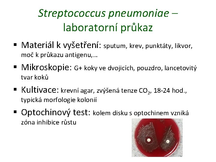 Streptococcus pneumoniae – laboratorní průkaz § Materiál k vyšetření: sputum, krev, punktáty, likvor, moč