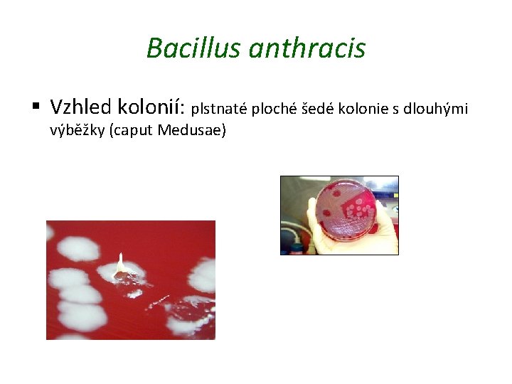 Bacillus anthracis § Vzhled kolonií: plstnaté ploché šedé kolonie s dlouhými výběžky (caput Medusae)