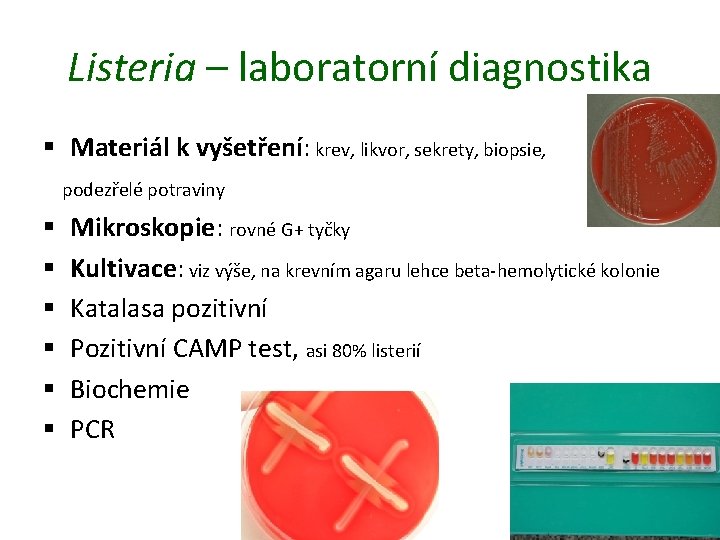 Listeria – laboratorní diagnostika § Materiál k vyšetření: krev, likvor, sekrety, biopsie, podezřelé potraviny